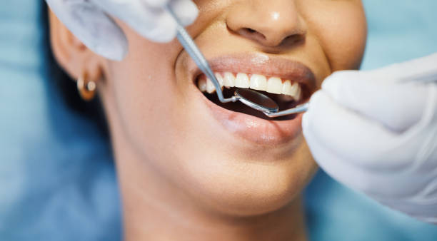 Best Emergency Dental Care for Broken or Chipped Teeth in Harlem Heights, FL